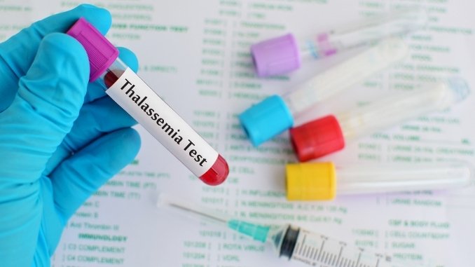 Thalassemia- The Disease And Its Treatment - Health News Digpu