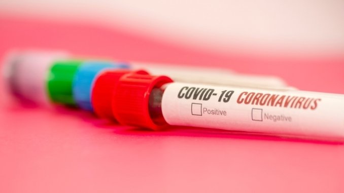 Covid-19 a new method to detect in less than five minutes researchers found