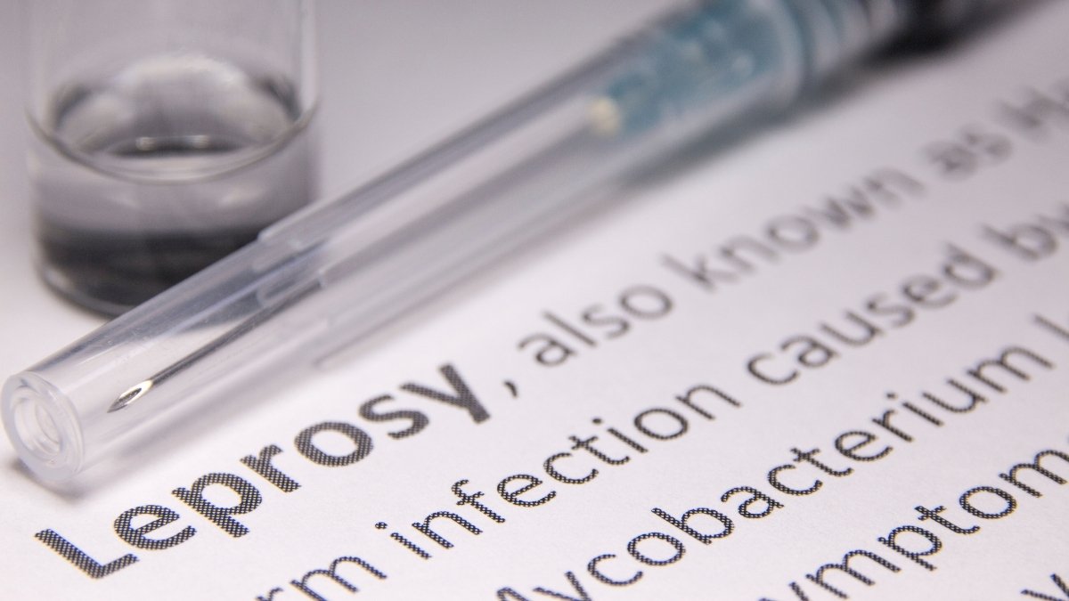 January 31st: World Leprosy Day - History and Background - Digpu