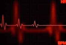 Heart Damages Found In Over Half Of COVID-19 Patients