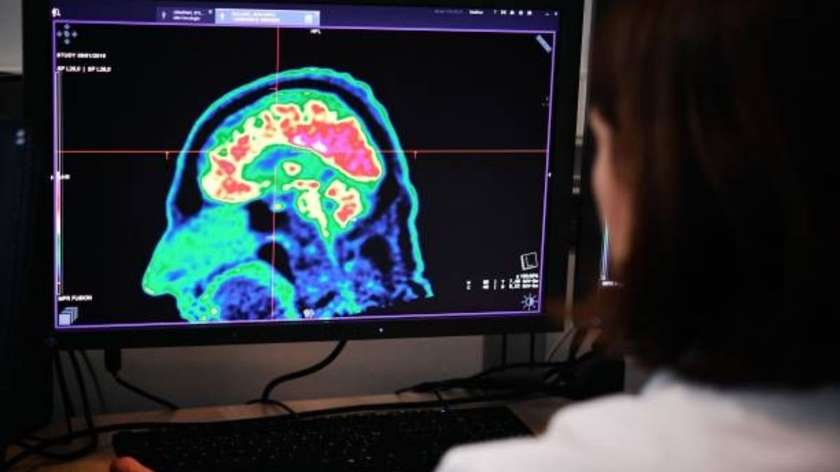 brain tumor