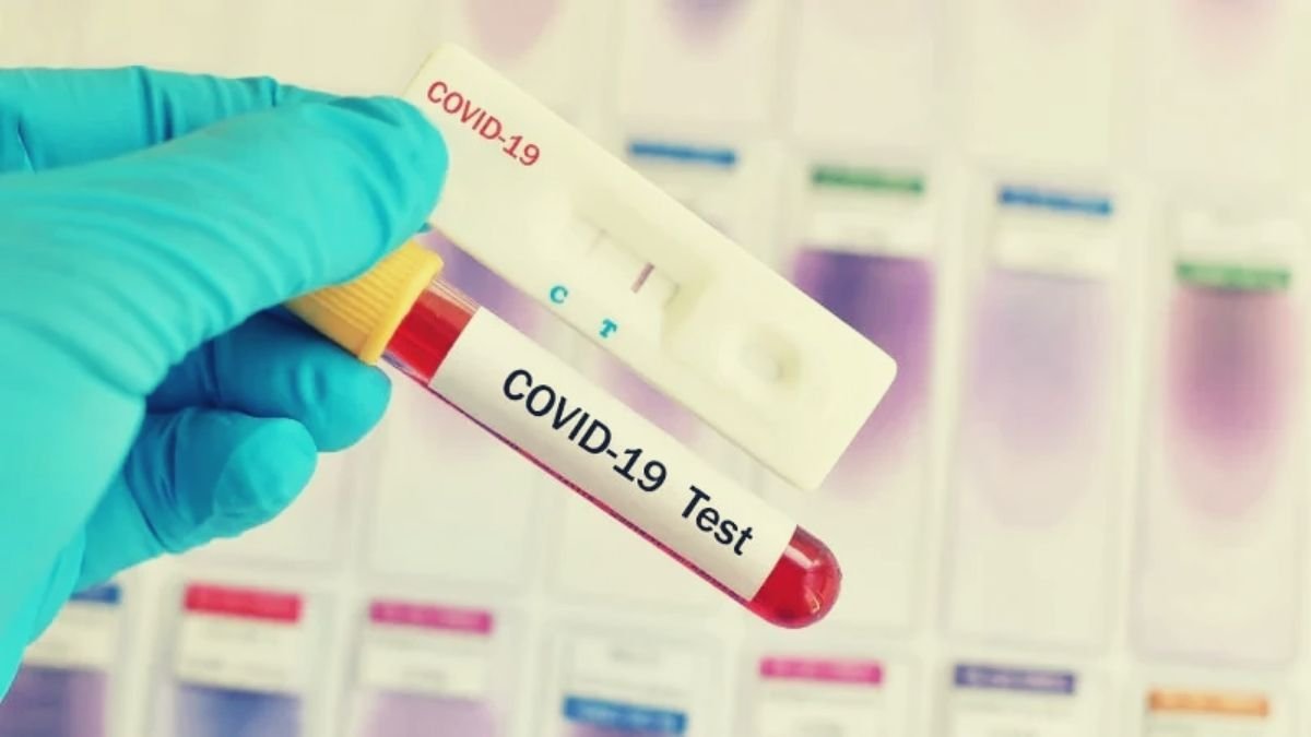 Scientist finds COVID-19 more reliable rapid tests (1)