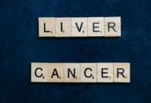liver cancer