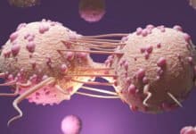 COVID Vaccine will lead to development of vaccine for Triple-Negative Breast Cancer