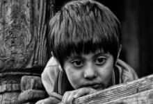 Child Wasting: J-K’s malnourished children point to poor socioeconomic conditions