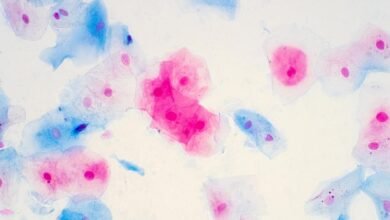 HPV immunization program has almost eradicated Cervical Cancer in women-Lancet Study