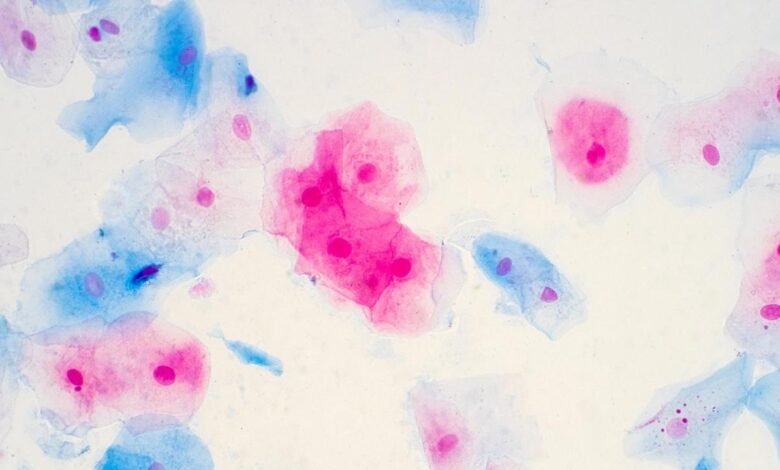 HPV immunization program has almost eradicated Cervical Cancer in women-Lancet Study