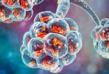 World Pneumonia Day and its significance amid COVID-19 pandemic