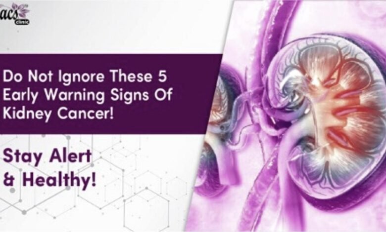Do not ignore these Five Early Warning signs of Kidney Cancer - Stay Alert and Healthy!