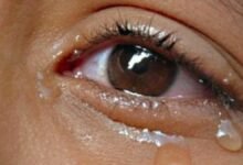 Testing tears could help in ascertaining Coronavirus presence