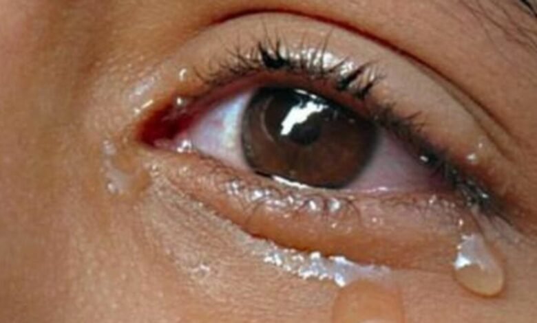Testing tears could help in ascertaining Coronavirus presence