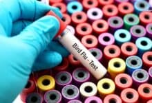Gaps in Bird Flu Surveillance Pose Pandemic Risk, Experts Warn