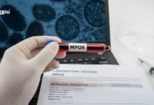 WHO Declares MPOX a Public Health Emergency: A New Global Health Challenge Emerges