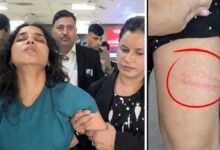 Freelance journalist Nafisa Khan of 4PM News brutally beaten during police detention in Delhi