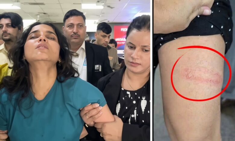 Freelance journalist Nafisa Khan of 4PM News brutally beaten during police detention in Delhi