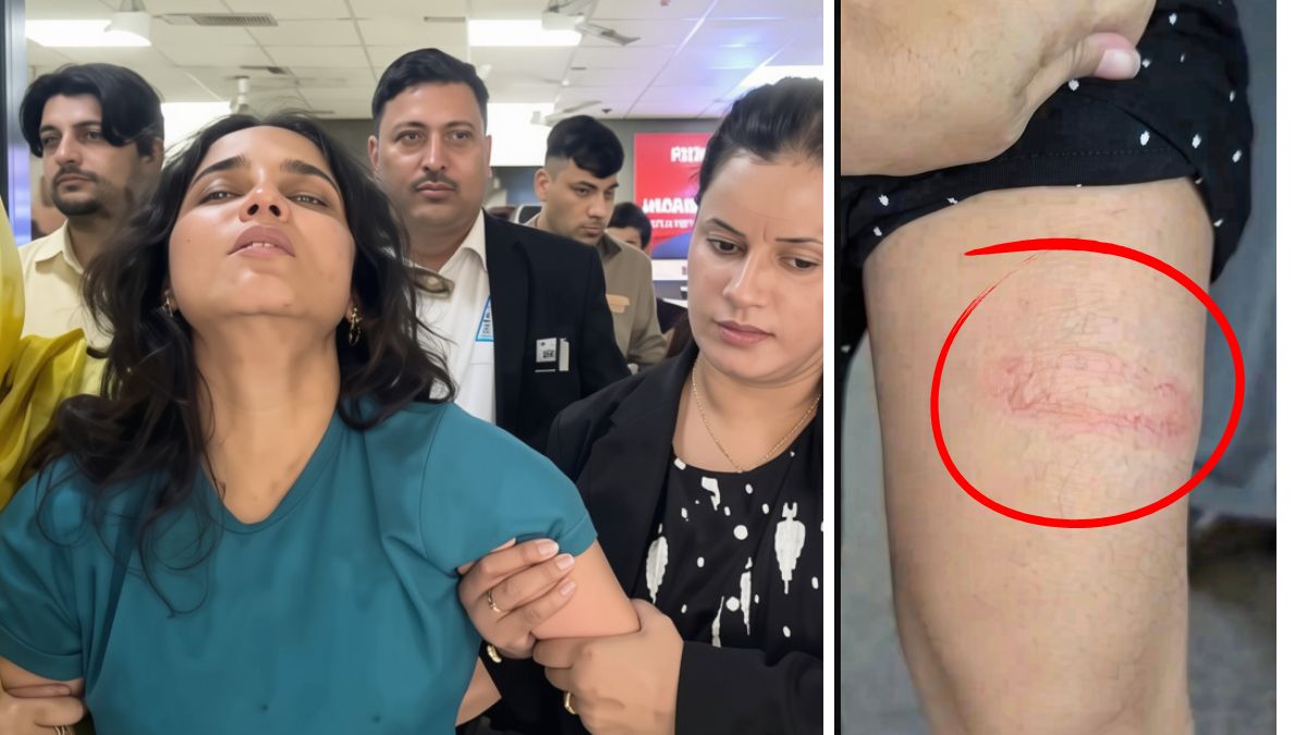 Freelance journalist Nafisa Khan of 4PM News brutally beaten during police detention in Delhi